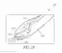 Fig. 03 - SURGICAL STAPLES