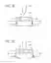 Fig. 04 - SURGICAL STAPLES