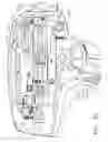 Fig. 26 - Surgical device with tandem fasteners