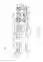 Fig. 28 - Rotary powered surgical instrument with manually actuatable bailout system