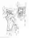 Fig. 35 - Rotary powered surgical instrument with manually actuatable bailout system
