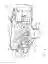 Fig. 05 - Anvil modification members for surgical staplers