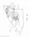 Fig. 16 - Anvil modification members for surgical staplers