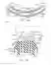 Fig. 77 - Anvil modification members for surgical staplers