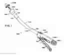 Fig. 02 - Expandable compression rings for improved anastomotic joining of tissues