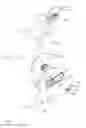 Fig. 11 - Surgical stapling system comprising a jaw closure lockout