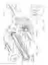 Fig. 16 - Surgical stapling system comprising a jaw closure lockout