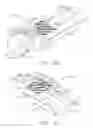 Fig. 17 - Surgical stapling system comprising a jaw closure lockout