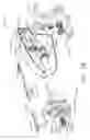 Fig. 58 - Surgical stapling system comprising a grooved forming pocket