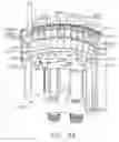 Fig. 75 - Surgical stapling system comprising a grooved forming pocket