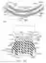 Fig. 76 - Surgical stapling system comprising a grooved forming pocket