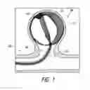 Fig. 02 - Embolic medical devices