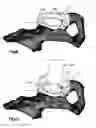 Fig. 07 - Device for a patient-specific acetabulum reaming and cup positioning guide