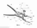 Fig. 03 - Navigated patella clamp