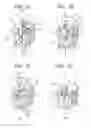 Fig. 02 - Surgical access devices having a cannula sidewall seal with a variable cross-sectional thickness