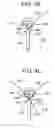 Fig. 09 - Surgical access devices having a cannula sidewall seal with a variable cross-sectional thickness