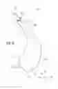 Fig. 02 - Facet joint replacement device and methods of use