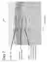Fig. 28 - METHODS AND DEVICES FOR THERMAL SURGICAL VAPORIZATION AND INCISION OF TISSUE