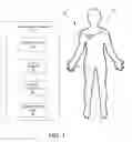 Fig. 02 - Screen sphere tissue ablation devices and methods