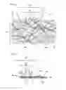 Fig. 09 - Methods and devices for soft tissue dissection