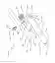 Fig. 47 - Methods and devices for soft tissue dissection