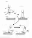 Fig. 56 - Methods and devices for soft tissue dissection