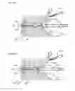 Fig. 72 - Methods and devices for soft tissue dissection
