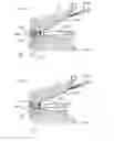 Fig. 74 - Methods and devices for soft tissue dissection