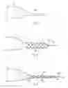 Fig. 02 - SLEEVE FOR SOFT TISSUE REPAIR