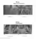 Fig. 08 - Soft tissue repair allografts and methods for preparing same