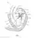 Fig. 02 - Sequentially deployed transcatheter mitral valve prosthesis