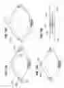 Fig. 08 - Expandable surgical heart valve indicators