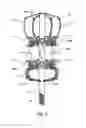Fig. 06 - Minimally invasive mitral valve replacement with brim