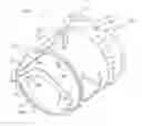 Fig. 01 - METHOD FOR TREATING AN AORTIC VALVE