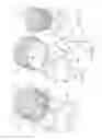 Fig. 02 - METHOD FOR TREATING AN AORTIC VALVE