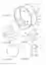 Fig. 08 - METHOD FOR TREATING AN AORTIC VALVE