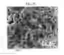 Fig. 08 - OSTEOSYNTHETIC IMPLANT AND MANUFACTURING METHOD THEREOF