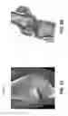 Fig. 03 - Acquiring and Utilizing Kinematic Information for Patient-Adapted Implants, Tools and Surgical Procedures