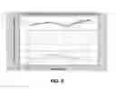Fig. 06 - Acquiring and Utilizing Kinematic Information for Patient-Adapted Implants, Tools and Surgical Procedures