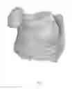 Fig. 02 - 3D-PRINTED UNIBODY MESH STRUCTURES FOR BREAST PROSTHESIS AND METHODS OF MAKING SAME