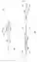 Fig. 02 - Stent deployment and postdilatation non-compliant balloon catheter and methods of use
