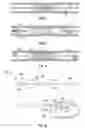 Fig. 06 - Stent deployment and postdilatation non-compliant balloon catheter and methods of use