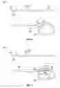 Fig. 08 - Stent deployment and postdilatation non-compliant balloon catheter and methods of use