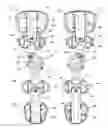 Fig. 01 - Orthopedic device