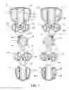 Fig. 02 - Orthopedic device
