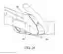 Fig. 20 - Orthopedic device