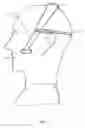 Fig. 02 - METHOD AND DEVICE FOR NASAL DILATION BY APPLYING FORCE TO A TARGET CHEEK AREA WITHOUT MANDIBULAR DISPLACEMENT