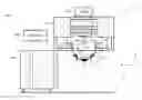Fig. 01 - Eye docking for laser eye surgery