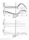 Fig. 16 - Movement assistance device
