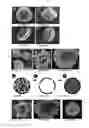 Fig. 02 - Immunomodulation using spores and pollen grains